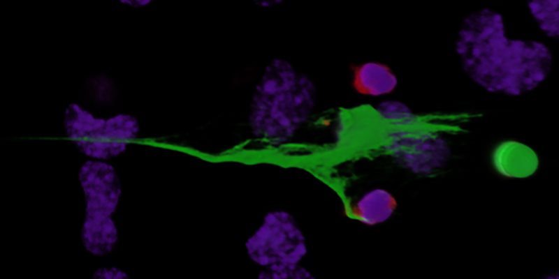 Neutrophil extracellular traps (green) expelled from activated neutrophils (red) after interacting with platelets captured from VWF released from endothelial cells (purple).