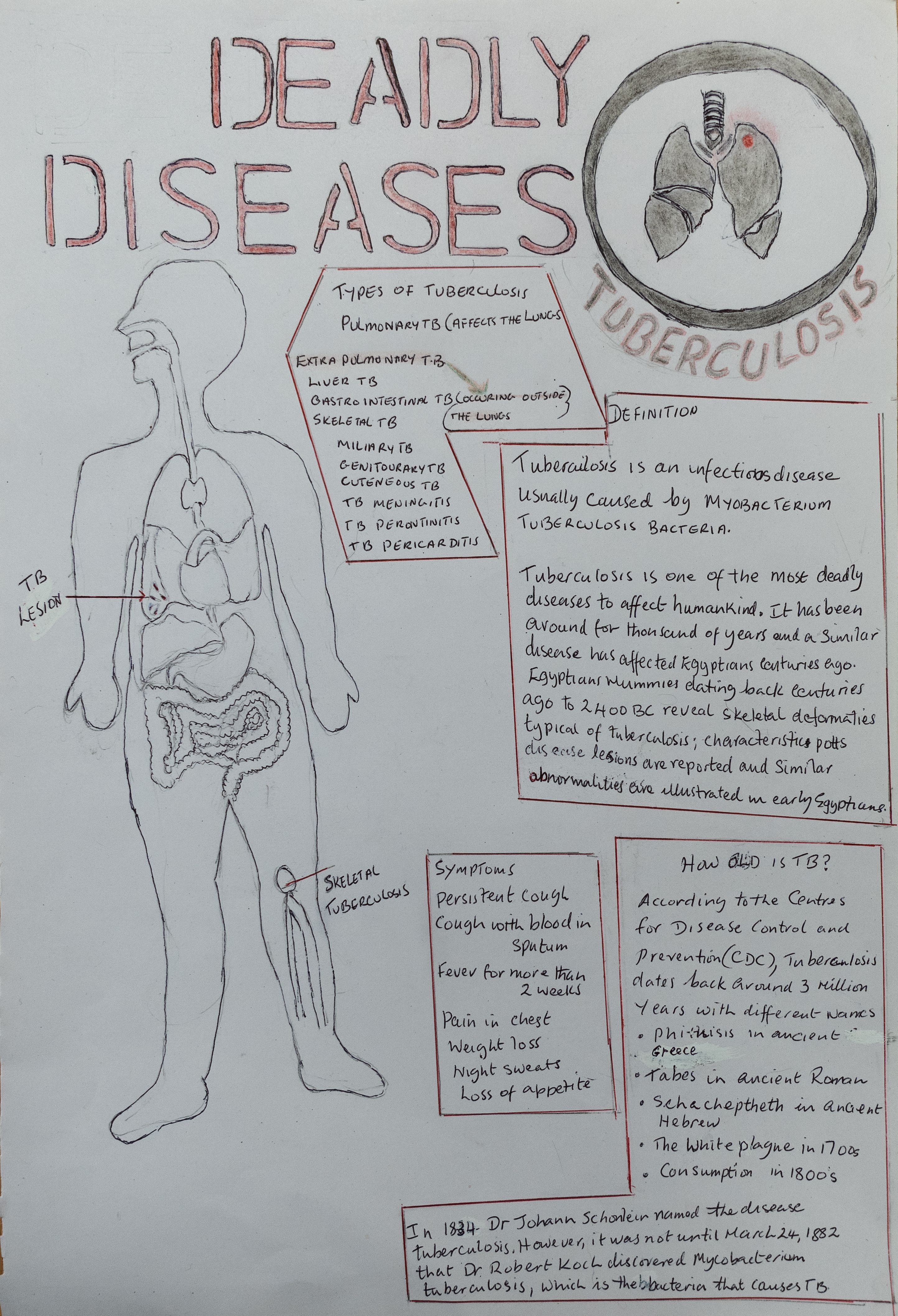 Deadly diseases: Tuberculosis