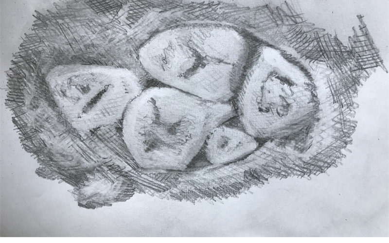 An illustration of gall stones.