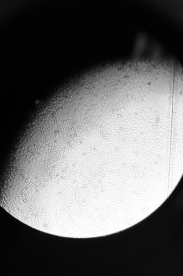 view from microscope by Dr Elizabetta Gropelli