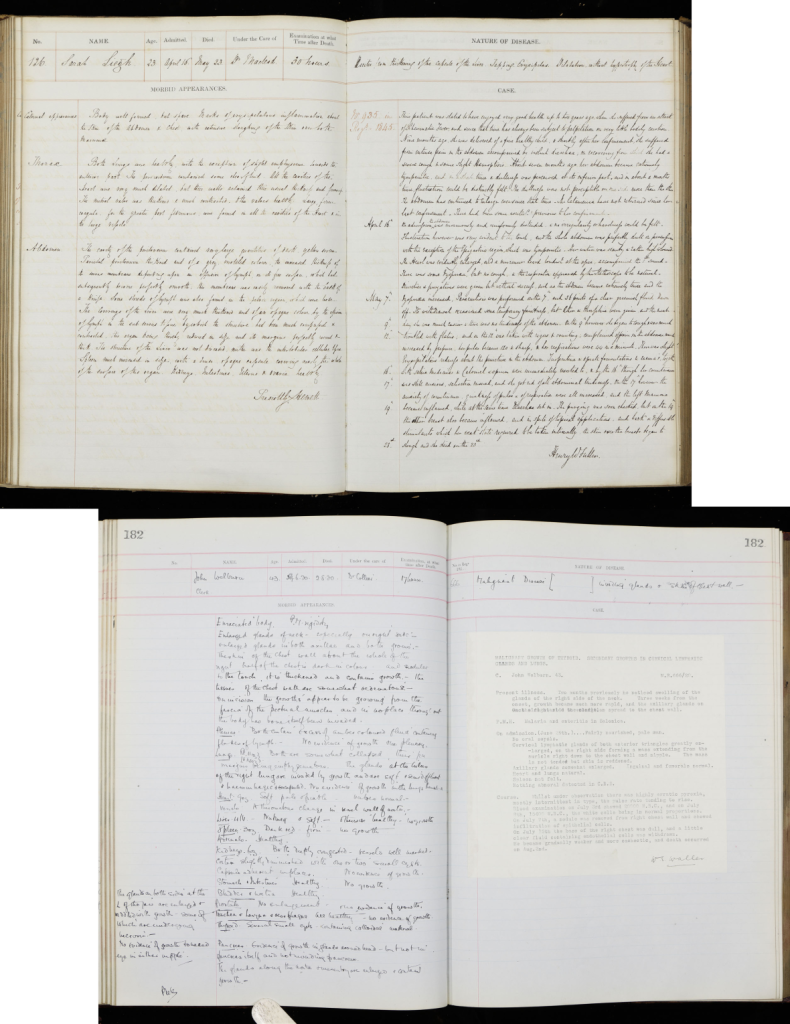 Post mortem examination book 1845 (Sarah Leigh, PM/1845/126) and Post mortem examination book 1920 (John Welburn, PM/1920/182). Archives and Special Collections, St George’s, University of London.