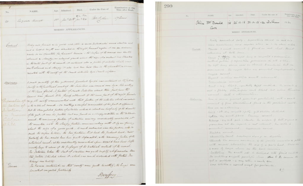 Post mortem case notes for Elizabeth Burnett in PM/1849/20, signed by Henry Gray; and Alice McDonald, PM/1918/290, signed by H.I. (Helen Ingleby). Archives and Special Collections, St George’s, University of London.