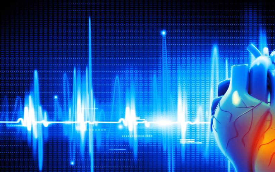 b2ap3_large_ecg-heart