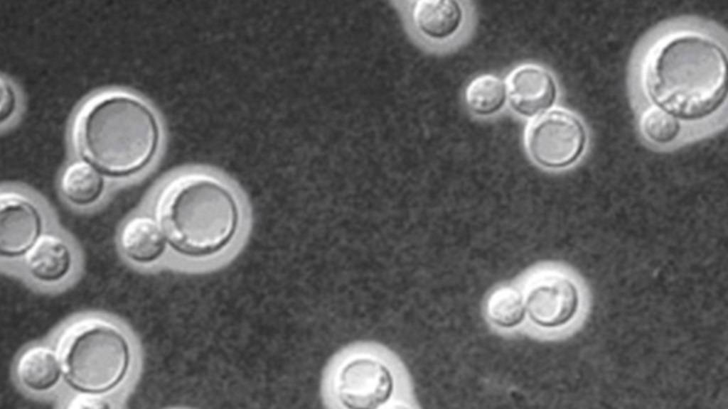 b2ap3_thumbnail_neoformans-yeast-hiv-Cropped--cc